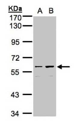 Western Blot: CCDC102B Antibody [NBP1-32619] - Sample (30ug whole cell lysate)A:Hep G2  B:MOLT4  7. 5% SDS PAGE, antibody diluted at 1:1000.