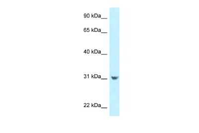 Western Blot: CCDC102B Antibody [NBP2-87139] - WB Suggested Anti-CCDC102B Antibody. Titration: 1.0 ug/ml. Positive Control: HepG2 Whole Cell