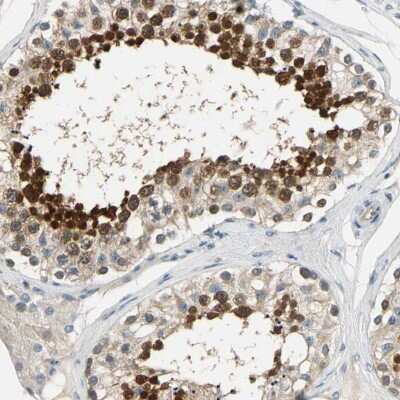 Immunohistochemistry-Paraffin: CCDC104 Antibody [NBP1-93513] - Staining of human testis shows strong cytoplasmic positivity in cells in seminiferous ducts.