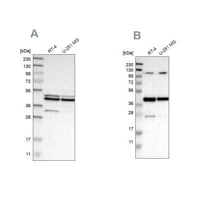 <b>Independent Antibodies Validation. </b>Western Blot: CCDC104 Antibody [NBP1-93513] - Analysis using Anti-CFAP36 antibody NBP1-93513 (A) shows similar pattern to independent antibody NBP1-93514 (B).