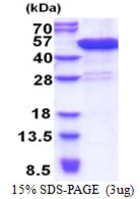 SDS-Page: CCDC104 Protein [NBP2-22787]
