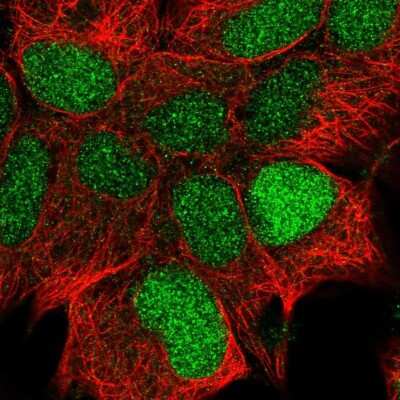 Immunocytochemistry/Immunofluorescence: CCDC106 Antibody [NBP2-30390] - Staining of human cell line HEK 293 shows positivity in nucleus. Antibody staining is shown in green.