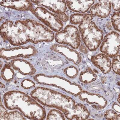 Immunohistochemistry-Paraffin: CCDC106 Antibody [NBP2-30390] - Staining of human kidney shows strong cytoplasmic positivity in cells in tubules.