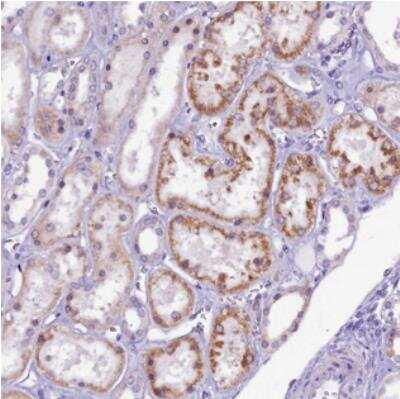 Immunohistochemistry: CCDC106 Antibody [NBP2-30542] - Staining of human kidney shows moderate positivity in tubules.