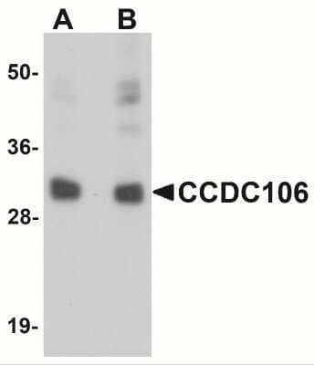Western Blot: CCDC106 Antibody [NBP1-77381] - Analysis of CCDC106 in human brain tissue lysate with CCDC106 antibody at (A) 0.5 and (B) 1 ug/mL.