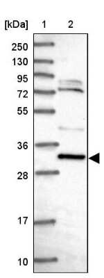 Western Blot: CCDC106 Antibody [NBP2-30390] - Lane 1: Marker  [kDa] 250, 130, 95, 72, 55, 36, 28, 17, 10.  Lane 2: Human cell line RT-4