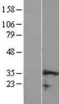 Western Blot: CCDC106 Overexpression Lysate (Adult Normal) [NBL1-08762] Left-Empty vector transfected control cell lysate (HEK293 cell lysate); Right -Over-expression Lysate for CCDC106.