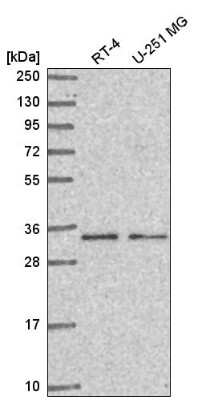 Western Blot: CCDC107 Antibody [NBP2-58785] - Western blot analysis in human cell line RT-4 and human cell line U-251 MG.