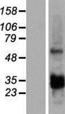 Western Blot: CCDC107 Overexpression Lysate (Adult Normal) [NBP2-05100] Left-Empty vector transfected control cell lysate (HEK293 cell lysate); Right -Over-expression Lysate for CCDC107.