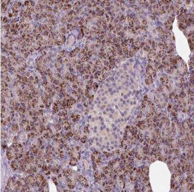Immunohistochemistry: CCDC108 Antibody [NBP2-30989] - Staining of human pancreas shows strong cytoplasmic positivity, with a granular pattern, in exocrine glandular cells.