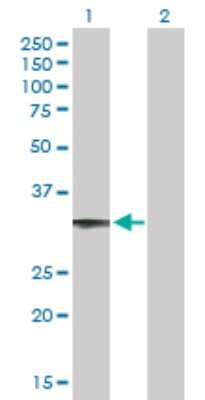 Western Blot: CCDC108 Antibody [H00255101-B01P] - Analysis of CCDC108 expression in transfected 293T cell line by CCDC108 polyclonal antibody.  Lane 1: DKFZp434O0527 transfected lysate(29.81 KDa). Lane 2: Non-transfected lysate.
