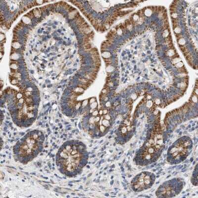 Immunohistochemistry-Paraffin: CCDC109A Antibody [NBP1-88534] - Immunohistochemical staining of human small intestine shows moderate to strong granular cytoplasmic positivity in glandular cells.