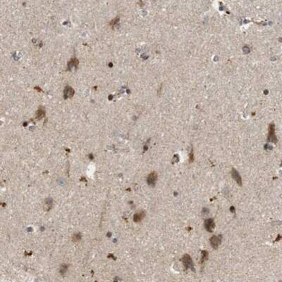 Immunohistochemistry-Paraffin: CCDC109A Antibody [NBP1-88534] - Immunohistochemical staining of human hippocampus shows moderate to strong granular cytoplasmic positivity in neurons.