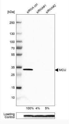 Western Blot: CCDC109A Antibody [NBP1-88534] - Analysis in A-549 cells transfected with control siRNA, target specific siRNA probe #1 and #2, using Anti-MCU antibody. Remaining relative intensity is presented. Loading control: Anti-PPIB.