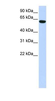 Western Blot: CCDC11 Antibody [NBP1-56790] - 293T cells lysate, concentration 0.2-1 ug/ml.
