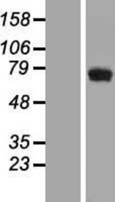 Western Blot: CCDC111 Overexpression Lysate (Adult Normal) [NBL1-08767] Left-Empty vector transfected control cell lysate (HEK293 cell lysate); Right -Over-expression Lysate for CCDC111.