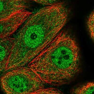 Immunocytochemistry/ Immunofluorescence CCDC112 Antibody