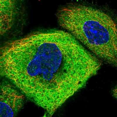 Immunocytochemistry/Immunofluorescence: CCDC112 Antibody [NBP2-48610] - Immunofluorescent staining of human cell line A-431 shows localization to plasma membrane & cytosol.