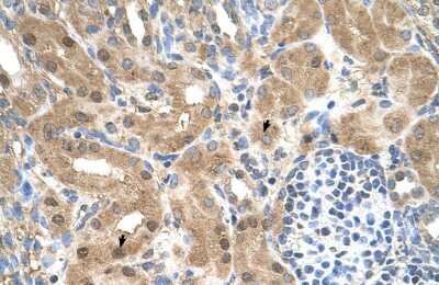 Immunohistochemistry-Paraffin: CCDC112 Antibody [NBP1-59468] - Human kidney Tissue, antibody concentration 4-8ug/ml. Cells with positive label: renal corpuscle cells (indicated with arrows) 400X magnification.