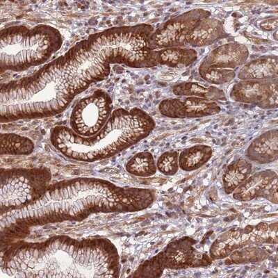 Immunohistochemistry-Paraffin CCDC112 Antibody