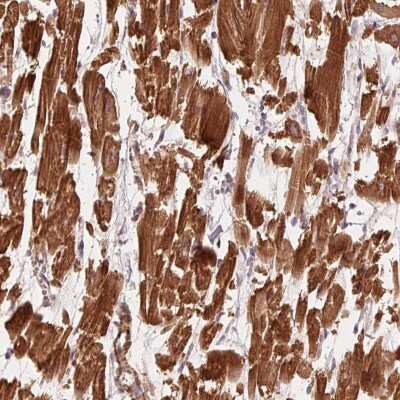 Immunohistochemistry-Paraffin: CCDC112 Antibody [NBP2-48610] - Staining of human heart muscle shows strong cytoplasmic positivity in myocytes.