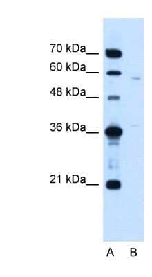 Western Blot: CCDC112 Antibody [NBP1-59468] - Jurkat cell lysate, Antibody Titration: 1.25ug/ml
