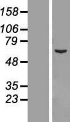 Western Blot: CCDC112 Overexpression Lysate (Adult Normal) [NBL1-08768] Left-Empty vector transfected control cell lysate (HEK293 cell lysate); Right -Over-expression Lysate for CCDC112.