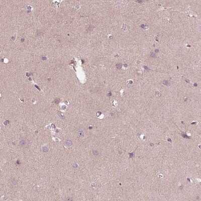 Immunohistochemistry-Paraffin: CCDC114 Antibody [NBP1-93863] - Staining of human cerebral cortex shows no positivity in neurons as expected.