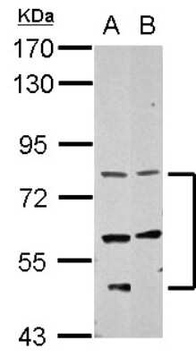 Western Blot: CCDC114 Antibody [NBP2-15740] - Sample (30 ug of whole cell lysate) A: NT2D1 B: SK-N-SH 7. 5% SDS PAGE gel, diluted at 1:2000.