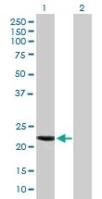 Western Blot: CCDC115 Antibody [H00084317-B01P] - Analysis of CCDC115 expression in transfected 293T cell line by CCDC115 polyclonal antibody.  Lane 1: MGC12981 transfected lysate(19.8 KDa). Lane 2: Non-transfected lysate.