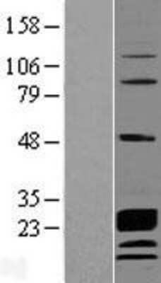 Western Blot CCDC115 Overexpression Lysate