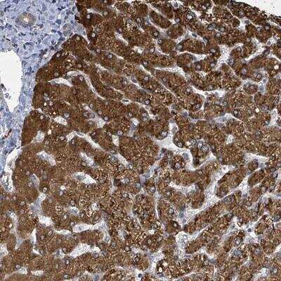 Immunohistochemistry-Paraffin: CCDC121 Antibody [NBP2-14744] - Staining of human liver shows strong cytoplasmic positivity in hepatocytes.