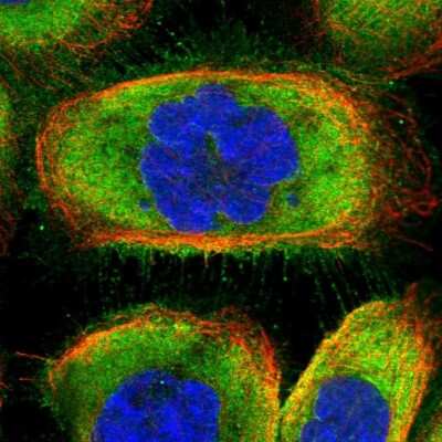 Immunocytochemistry/Immunofluorescence: CCDC124 Antibody [NBP2-48746] - Staining of human cell line A-431 shows localization to plasma membrane & cytosol. Antibody staining is shown in green.