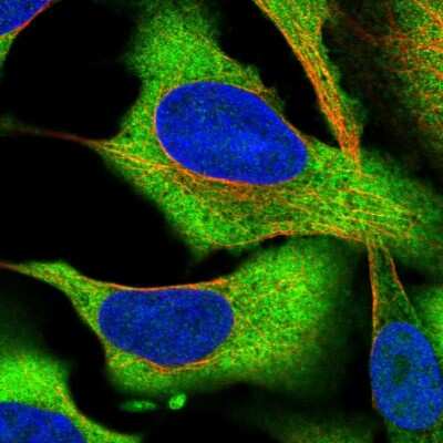 Immunocytochemistry/ Immunofluorescence CCDC124 Antibody - BSA Free