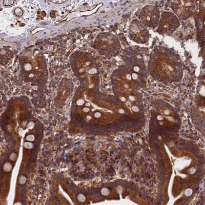 Immunohistochemistry-Paraffin: CCDC124 Antibody [NBP2-48746] - Staining of human duodenum shows strong cytoplasmic positivity in glandular cells.