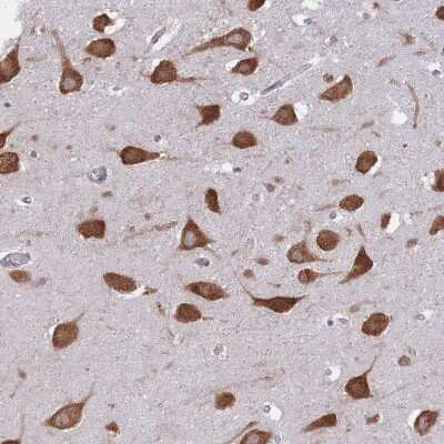 Immunohistochemistry-Paraffin: CCDC124 Antibody [NBP2-48858] - Staining of human hippocampus shows strong cytoplasmic positivity in neuronal cells.