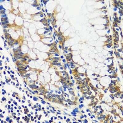 Immunohistochemistry-Paraffin: CCDC124 Antibody [NBP2-92737] - Paraffin-embedded human colon using CCDC124 .
