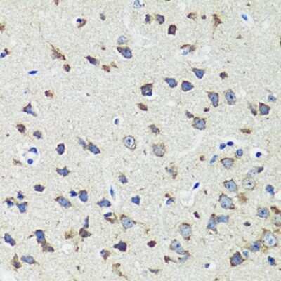 Immunohistochemistry-Paraffin: CCDC124 Antibody [NBP2-92737] - Paraffin-embedded mouse brain using CCDC124 .