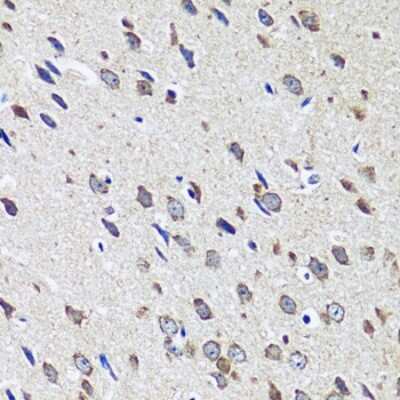 Immunohistochemistry-Paraffin: CCDC124 Antibody [NBP2-92740] - Paraffin-embedded mouse brain using CCDC124 .