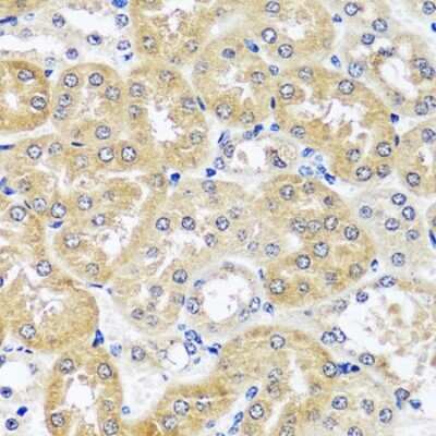 Immunohistochemistry-Paraffin: CCDC124 Antibody [NBP2-92740] - Paraffin-embedded mouse kidney using CCDC124 .