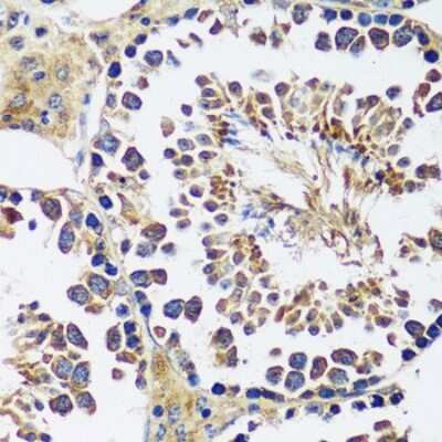 Immunohistochemistry-Paraffin: CCDC124 Antibody [NBP2-92740] - Paraffin-embedded mouse testis using CCDC124 .