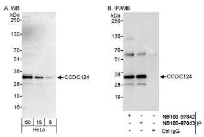 Western Blot: CCDC124 Antibody [NB100-97843] - Detection of Human CCDC124 on HeLa whole cell lysate using NB100-97843. CCDC124 was also immunoprecipitated by rabbit anti-CCDC124 antibody NB100-97842.