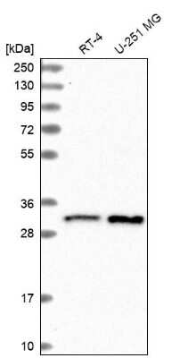 Western Blot CCDC124 Antibody - BSA Free