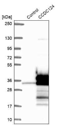 Western Blot: CCDC124 Antibody [NBP2-48746] - Analysis in control (vector only transfected HEK293T lysate) and CCDC124 over-expression lysate (Co-expressed with a C-terminal myc-DDK tag (3.1 kDa) in mammalian HEK293T cells).