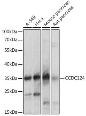 Western Blot CCDC124 Antibody - Azide and BSA Free