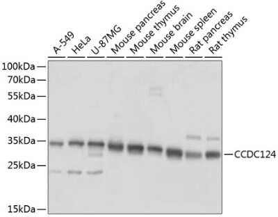 Western Blot: CCDC124 Antibody [NBP2-92740] - Analysis of extracts of various cell lines, using CCDC124 at 1:1000 dilution.Secondary antibody: HRP Goat Anti-Rabbit IgG (H+L) at 1:10000 dilution.Lysates/proteins: 25ug per lane.Blocking buffer: 3% nonfat dry milk in TBST.Detection: ECL Basic Kit .Exposure time: 1s.