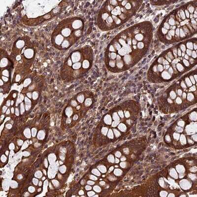 Immunohistochemistry-Paraffin: CCDC125 Antibody [NBP1-93660] - Staining of human colon shows strong cytoplasmic positivity in glandular cells.