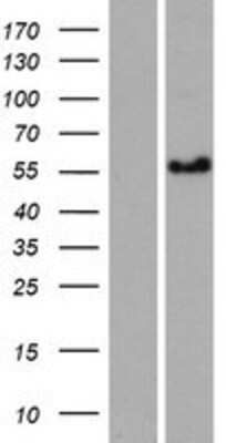 Western Blot: CCDC125 Overexpression Lysate (Adult Normal) [NBP2-04999] Left-Empty vector transfected control cell lysate (HEK293 cell lysate); Right -Over-expression Lysate for CCDC125.