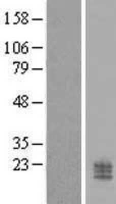 Western Blot: CCDC126 Overexpression Lysate (Adult Normal) [NBL1-08775] Left-Empty vector transfected control cell lysate (HEK293 cell lysate); Right -Over-expression Lysate for CCDC126.