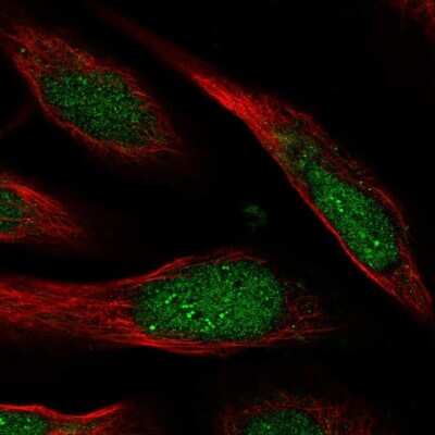 Immunocytochemistry/Immunofluorescence: CCDC127 Antibody [NBP1-91756] - Staining of human cell line U-2 OS shows localization to nucleus & nucleoli fibrillar center.
